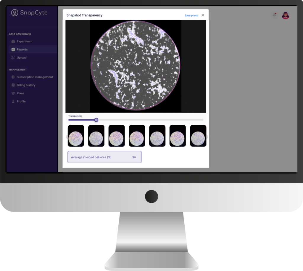 SnapCyte platform analyzing transwell migration assay image