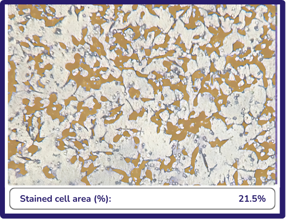 invasion assay stained membrane analyzed with AI