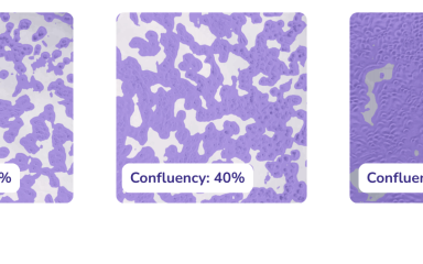 cell confluency percentage