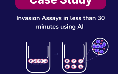 SnapCyte™ analysis of transwell membrane with stained cells